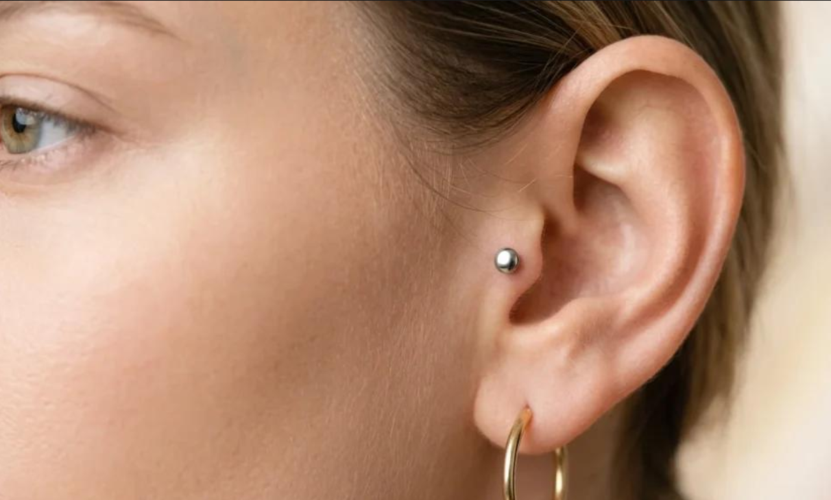 Is Titanium Hypoallergenic?