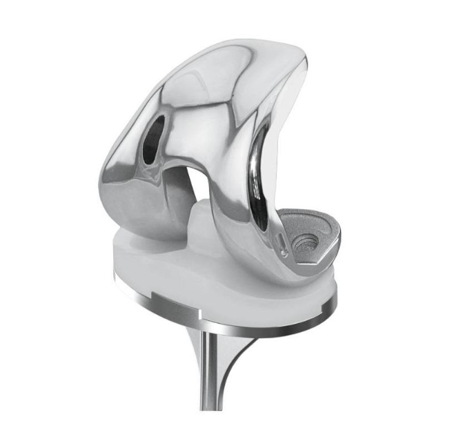 How Much Does a Titanium Knee Replacement Weigh?h?